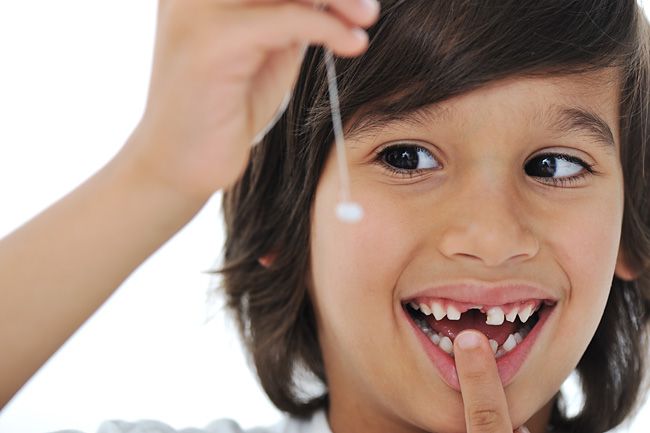 Что делать, если у ребенка шатается молочный зуб