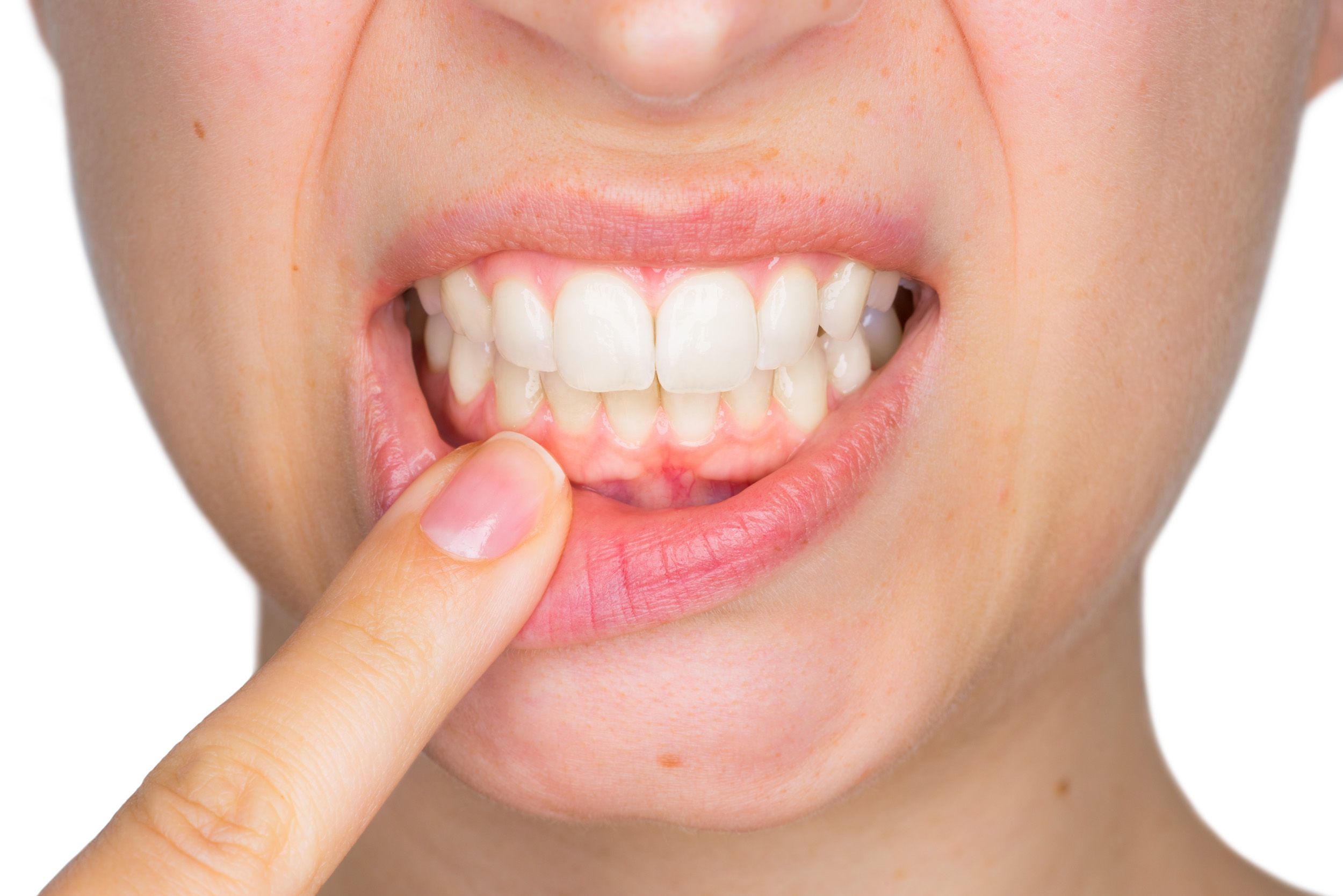Болят зубы и десны после обточки: почему, что делать