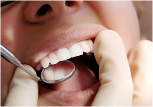 Осмотр стоматолога для определения гингивита