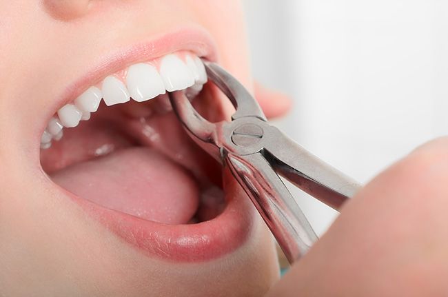 Воспаление десен после удаления зуба