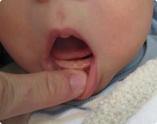 Фото: симптомы того, что у ребенка режутся зубы