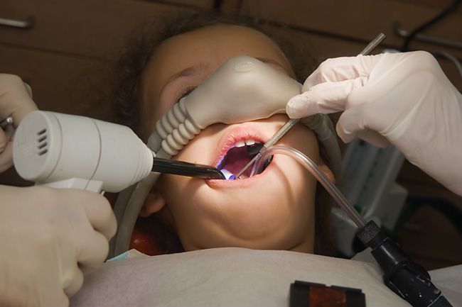 Лечение зубов детям под общим наркозом
