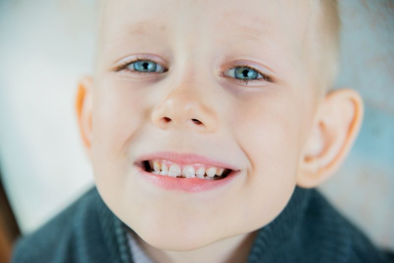 Кариес детских зубов до 3 лет лечение